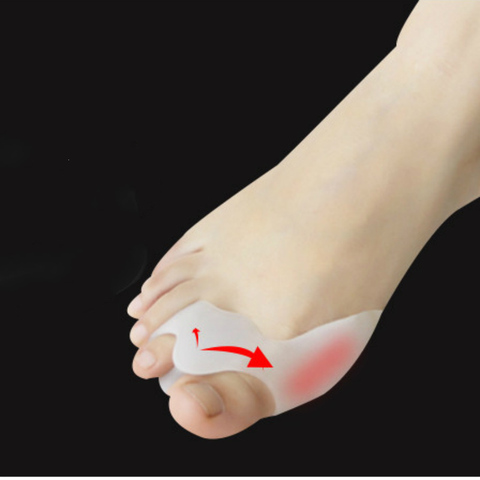 Corrector de Hallux Valgus hueso pulgar ortésica, ortopédica 1 par de silicona gran separador de dedos para juanete Corrector pedicura para el cuidado de los pies herramienta ► Foto 1/6