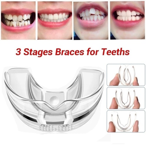 3 etapas Dental Ortodoncia de soportes alineación entrenador retenedor Dental bruxismo boca dientes plancha ► Foto 1/5