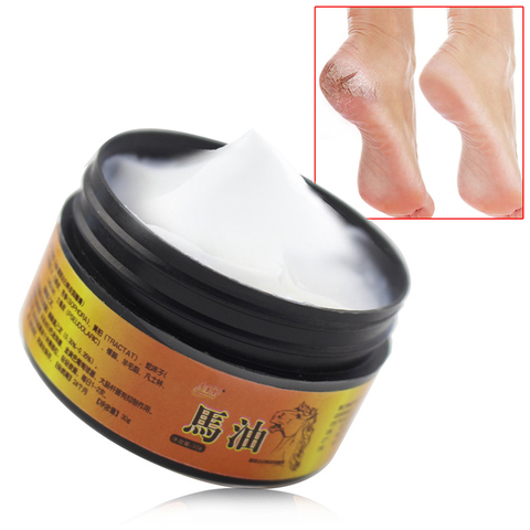 Aceite caballo Crema para pies crema de talón para pies máscara pica ampollas Anti-agrietamiento reparación Peeling para crema para cuidado del pie pedicura 45g ► Foto 1/6