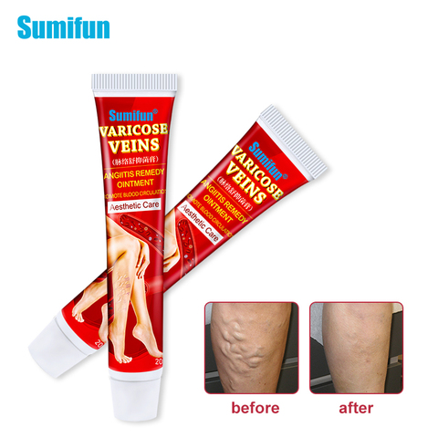 Sumifun-Crema de tratamiento de venas varicosas, 1/2 Uds., pomada médica Original para aliviar el dolor de vascilitis, flebitis, araña ► Foto 1/6