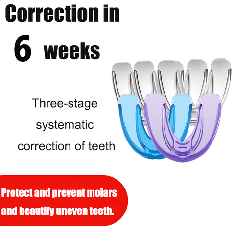 Aparatos de ortodoncia de silicona instantáneos Alineación de dientes con sonrisa, retenedor Dental, llaves de protección ► Foto 1/6