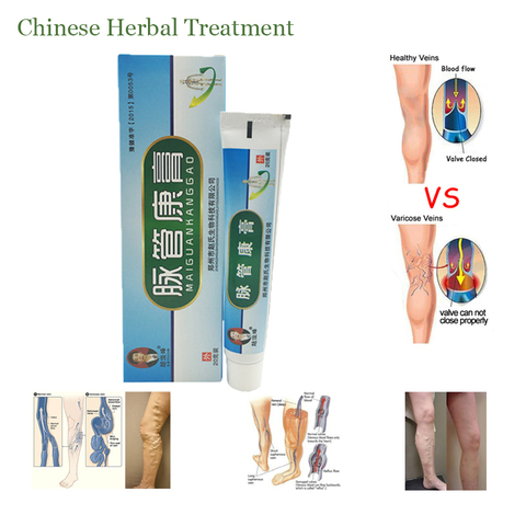 Ungüento para masaje de inflamación varices, medicina natural china, a base de hierbas, 1 caja ► Foto 1/6