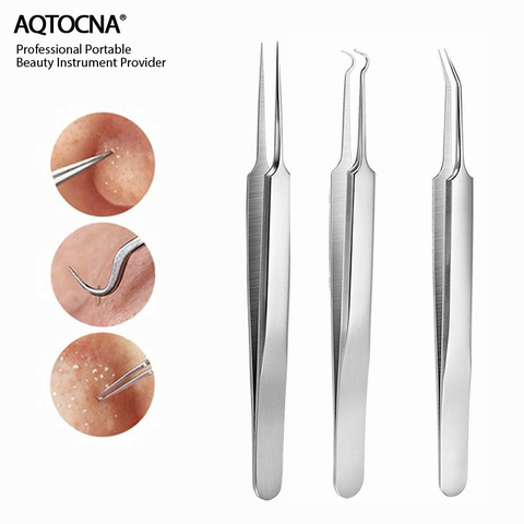 AQTOCNA 3 unids/set Blackhead Comedone acné Clip grano herramienta removedor de la espinilla pinzas para herramienta para cuidado de la piel Facial limpiador de poros ► Foto 1/6