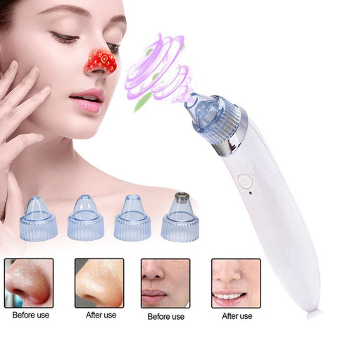 Juego de removedor de espinillas para el cuidado de la piel, herramienta de succión de espinillas y acné al vacío, dermoabrasión Facial, máquina de belleza para limpieza Facial, 1 Set ► Foto 1/1