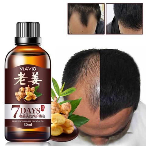 Aceite esencial para el crecimiento del cabello, tratamiento efectivo para la pérdida del cabello, suero de jengibre para el crecimiento del cabello, belleza para el cuidado de la salud, 30ml, 7 días de batería ► Foto 1/6