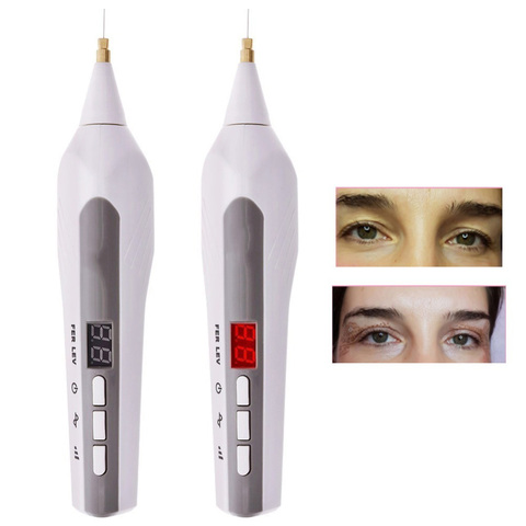 Pluma de Plasma para levantamiento de piel facial, pluma de Plasma para eliminación de párpados, manchas de arrugas, fibroplasto ► Foto 1/6