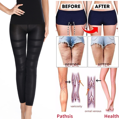 Leggings de compression anti-cellulite, vêtement amincissant, galbant, amincissement des jambes, façonneur corporel, taille haute, culotte de contrôle du ventre, cuisses plus fines ► Photo 1/6