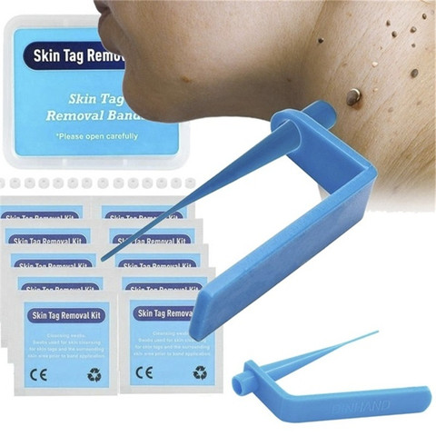 Étiquettes médicales pour la peau, anti-taupes, Micro bande, Kit de suppression de la peau, avec tampons de nettoyage, soins du visage pour adulte ► Photo 1/5