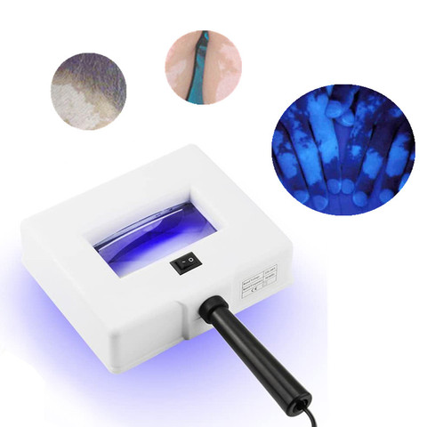 Bois UV lampe analyseur d'évaluation de la peau peau du visage Vitiligo test examen loupe peau grise Tinea UV lampe ► Photo 1/6