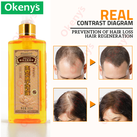Véritable professionnel cheveux gingembre shampooing 300 ml, repousse des cheveux Dense rapide, plus épais, shampooing Anti perte de cheveux produit ► Photo 1/6