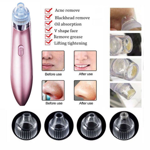 Aspirateur électrique pour nettoyeur de pores du visage, pour éliminer l'acné, les points noirs du visage, appareil professionnel pour soins de la peau ► Photo 1/6