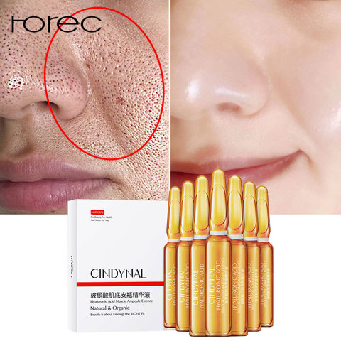 ROREC – sérum pour le visage, acide hyaluronique, Ampoule, resserre les Pores, Anti-acné, Nicotinamide, blanchissant, hydratant, Anti-âge, Anti-rides, soins pour la peau ► Photo 1/6