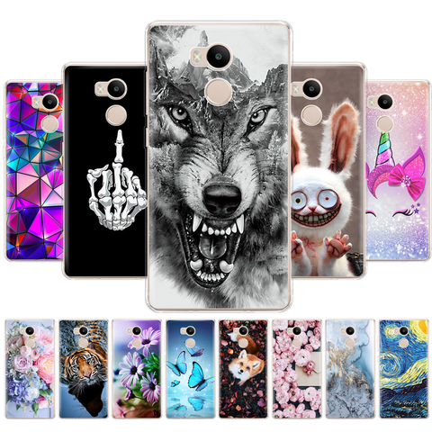 Coque de protection complète en silicone pour xiaomi, compatible modèles Redmi 4 pro, 4 prime, 360 °c ► Photo 1/6