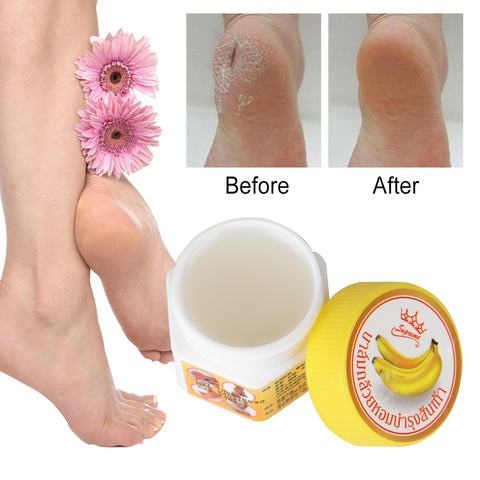 Crème de Massage à l'huile de banane, Anti-fongique pour le talon pour les mains, outil efficace de soins pour la peau, nourrissant et doux, nourrit les fissures et les pieds ► Photo 1/6