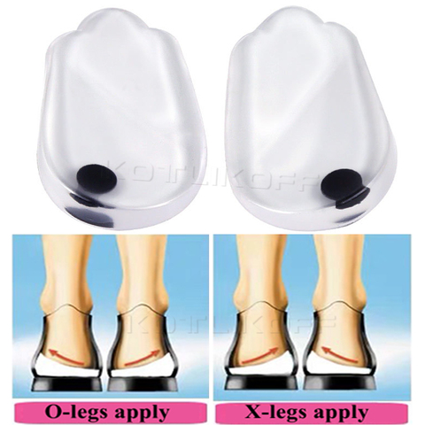 Semelles de Massage magnétiques, orthèses pour les jambes, Type O/X, coussinets correctifs Valgus Varus, semelles de Massage magnétique pour les pieds, tampons d'insertion ► Photo 1/6