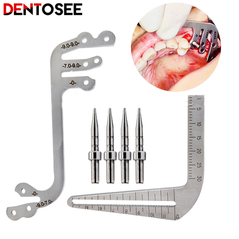 Ensemble de guides dentaires pour plantation buccale, localisateur, Guide de positionnement, perçage, règle d'angle, outils pour Implant, dentiste ► Photo 1/5