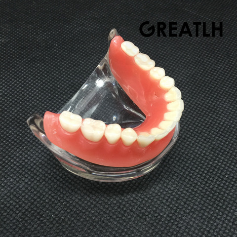 Suture dentaire, modèle de dents inférieures, mandibulaire avec implants, restauration, enseignement dentaire ► Photo 1/5