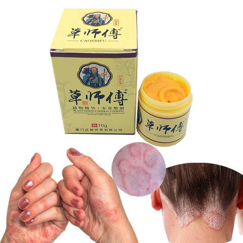 5 pièces médecine chinoise naturelle à base de plantes anti-bactéries crème Psoriasis eczéma pommade traitement haute qualité crème à base de plantes ► Photo 1/6