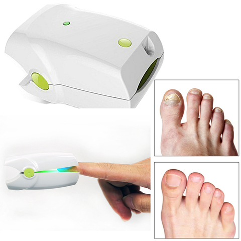 Dispositif Laser de nettoyage des ongles, contre les champignons, pour thérapie à la lumière bleue, 905nm 470nm ► Photo 1/6