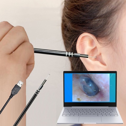 Outil multifonctionnel de nettoyage des oreilles USB, nouveau, Endoscope de nettoyage des oreilles, cuillère à oreille visuelle HD, cure-oreille avec Mini stylo caméra ► Photo 1/5