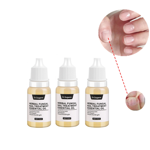 3 pièces Dr.Sugarm soins des pieds fongique traitement des ongles Essence ongles orteil ongles élimination des champignons Gel Anti-Infection Paronychia onychomycose ► Photo 1/5