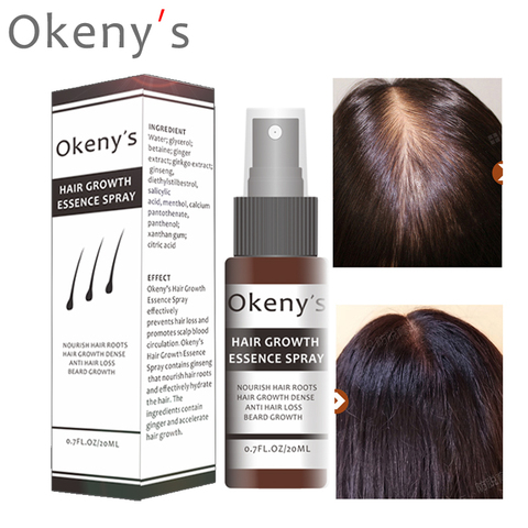 Okeny's gingembre cheveux croissance Essence Spray 20ml cultiver restauration pain huile sérum pour homme femme Anti perte de cheveux prévenir la calvitie ► Photo 1/6