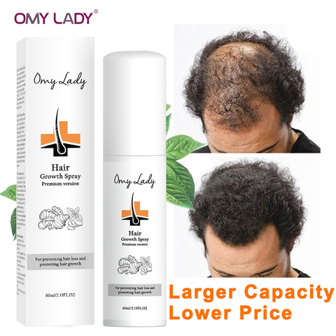 60ML OMYLADY Anti perte de cheveux croissance des cheveux Spray huile essentielle liquide pour hommes femmes sèche cheveux régénération réparation, produits de perte de cheveux ► Photo 1/1