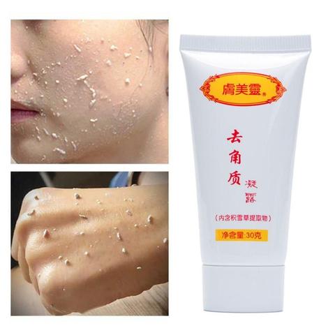 Gel exfoliant, exfoliant, exfoliant, exfoliant, contrôle de l'huile, pour le visage et le corps, soins de la peau, nouveauté ► Photo 1/6