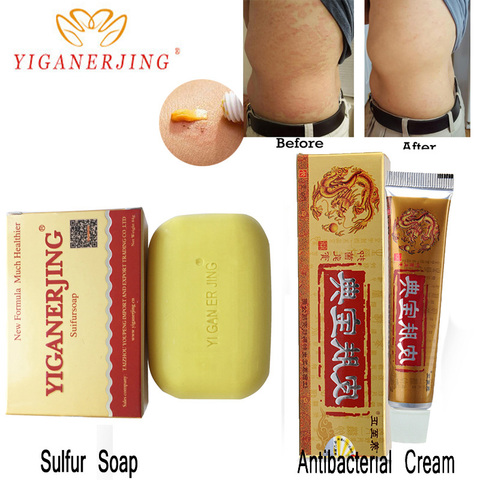 Yiganerjing Psoriasis crème dermatite eczematoïde eczéma onguent traitement de la peau patchs de Massage du corps en gros ► Photo 1/5