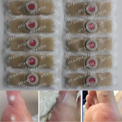 100 Pcs/lot Foot Care Medical Plaster Foot Corn Removal Calluses Plantar Warts Thorn Plaster Health Care For Relieving Pain ► Photo 1/4