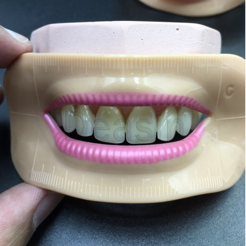 Outil de mesure de bouche de laboratoire de prothèse dentaire, outil de mesure de lèvre, pièces esthétiques 4 pièces de forme différente ► Photo 1/4