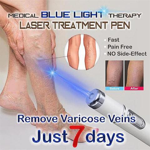 Santé thérapie par la lumière bleue traitement des varices stylo Laser cicatrice douce élimination des rides traitement acné Laser stylo Massage se détendre ► Photo 1/6