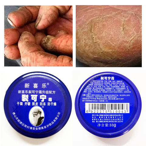 Puissant traditionnel chinois 33g Anti-séchage fissure pied crème talon fissuré réparation crème enlèvement peau morte main pieds soins ► Photo 1/6