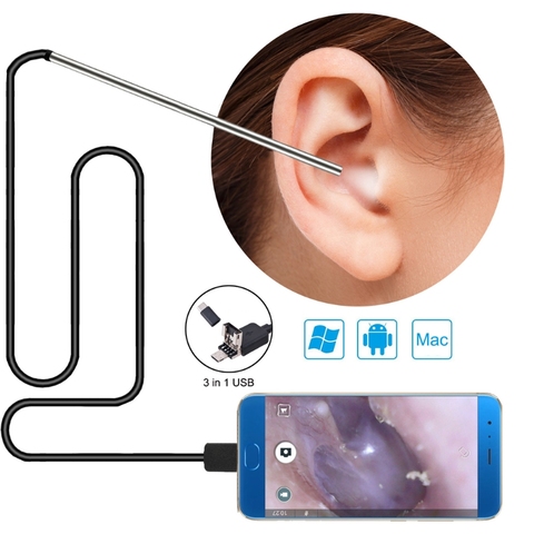 3 dans 1 outil de retrait de cire d'oreille, Otoscope d'usb-caméra de portée d'oreille dans l'otoscope visuel de nettoyage d'oreille d'endoscope 5.5mm Otoscope de choix d'oreille ► Photo 1/6