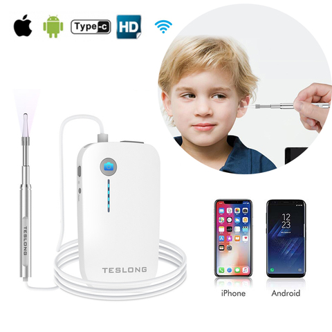 Caméra Endoscope auriculaire HD sans fil, 4.3mm, Wifi, otoscope médical 1080p, soins visuels de l'oreille, caméra d'inspection du cérumen pour téléphone ios et Android ► Photo 1/6