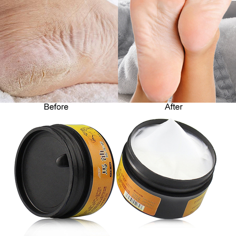 1pc huile de cheval pieds crème talon crème pour pieds d'athlète masque démangeaisons cloques crème anti-gerçures Peeling pour soin des pieds TSLM2 ► Photo 1/6