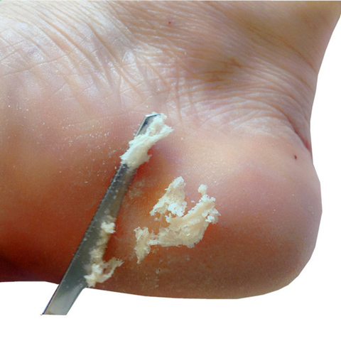 Acier inoxydable pied maïs dissolvant pédicure couteau main soins des pieds callosités peau morte décapant grattoir pédicure soins des pieds outils ► Photo 1/6