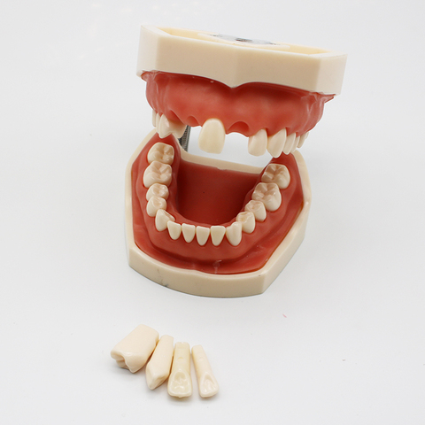 Modèle dentaire modèle de dents dents de gomme modèle d'enseignement modèle de Typodont dentaire Standard démonstration avec dent amovible 200H ► Photo 1/6