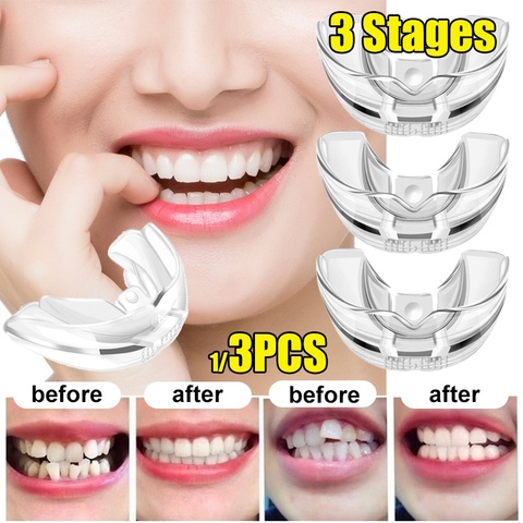 3 pièces/ensemble dent orthodontique formateur dentaire appareil dentaire alignement orthèse Silicone matériel professionnel garde lisseur ► Photo 1/6