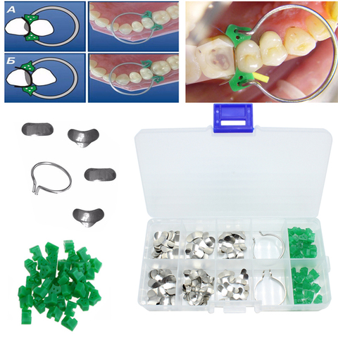 100 pièces/boîte dentaire sectionnel Matrices profilées matrice anneau Delta cales ► Photo 1/6