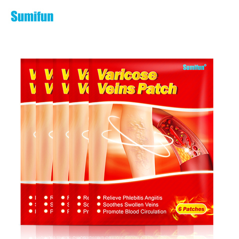 Patch médical chinois pour l'élimination des varices, 30 pièces = 5 sacs, vascularite, phlébite, araignée, soins pour la peau ► Photo 1/6