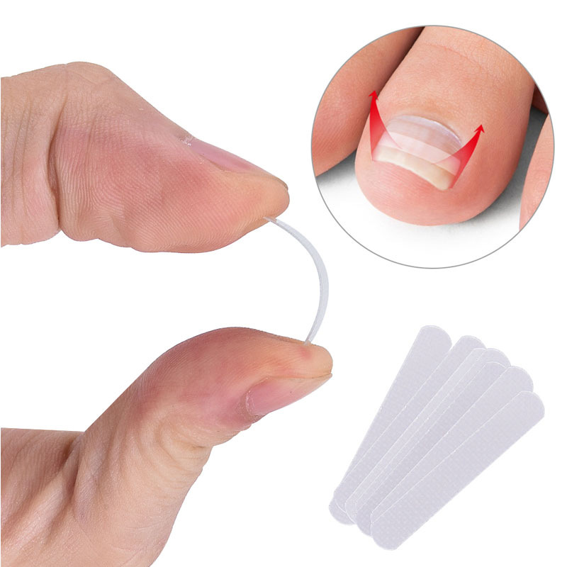 10 pièces incarné ongle outil de Correction incarné orteil traitement des ongles élastique Patch autocollant redressage pince orthèse pédicure outil ► Photo 1/6