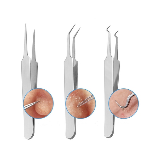 Pincettes professionnelles, 3 modèles pour Nail Art/soins du visage/Extension de cils, outils pour éliminer les points noirs, les boutons, les imperfections, l'acné, 1 pièce ► Photo 1/3