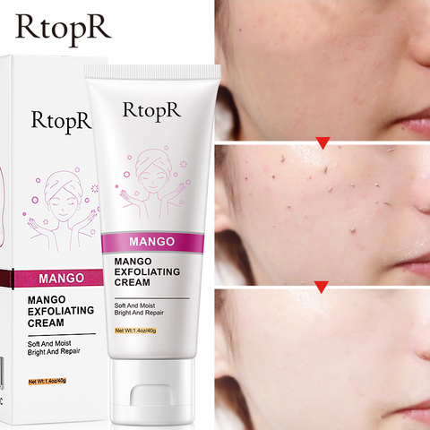 RtopR Gel exfoliant pour le visage crème blanchissant hydratant gommage pour le visage clair acné points noirs gommage pour le visage ► Photo 1/6