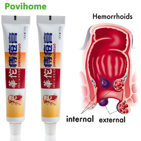 Мазь от геморроя, 1 шт., 25 г, китайские травы, трещины, внутренний и внешний анальный трещины, крем для облегчения боли, медицинский пластырь, з... ► Фото 1/6