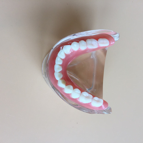 Стоматологическая модель зубного протеза, съемный внутренний мандибуляр с 2 имплантатами для обучения зубам ► Фото 1/3